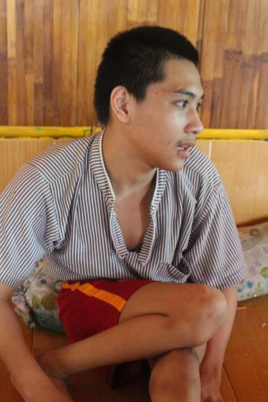 bại não - khuyết tật - Hình mô tả 10