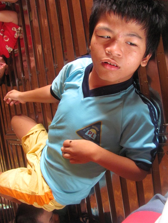 Các em bại não - Hình mô tả 18