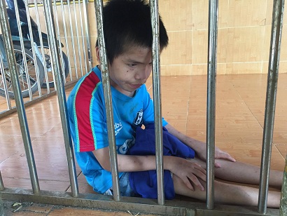 bại não - khuyết tật - Hình mô tả 2