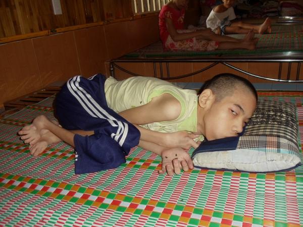 Các em bại não - Hình mô tả 13