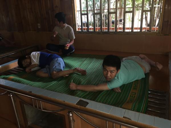 bại não - khuyết tật - Hình mô tả 7