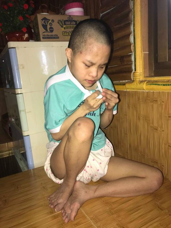 Em sinh ra cũng muốn được làm người. Có đầy đủ nét vui tươi con trẻ......... - Hình mô tả 8