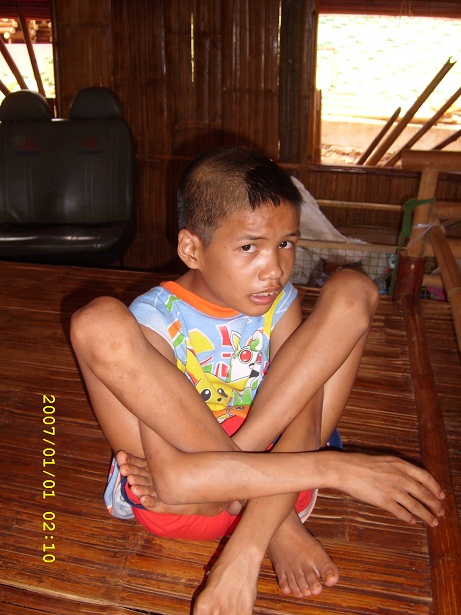 Các em bại não - Hình mô tả 16