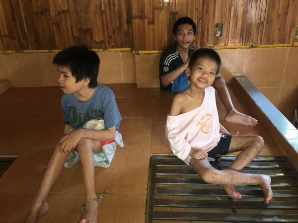 bại não - khuyết tật - Hình mô tả 8